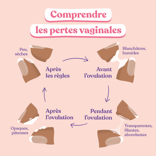 Que faire contre les pertes blanches et les odeurs ?